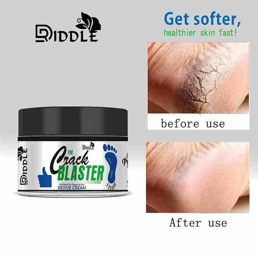 Driddle Foot Crack Remover Cream For Women & Men Pack of 2