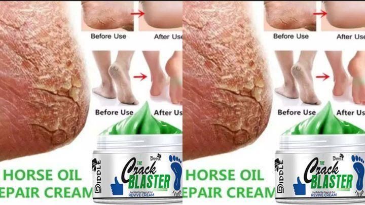 Driddle Foot Crack Remover Cream For Women & Men Pack of 2